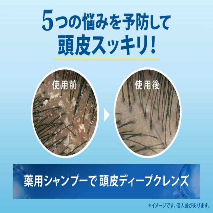 h&s 5in1 コンデイショナー 2000g h&s 5in1 コンデイショナー 2000g