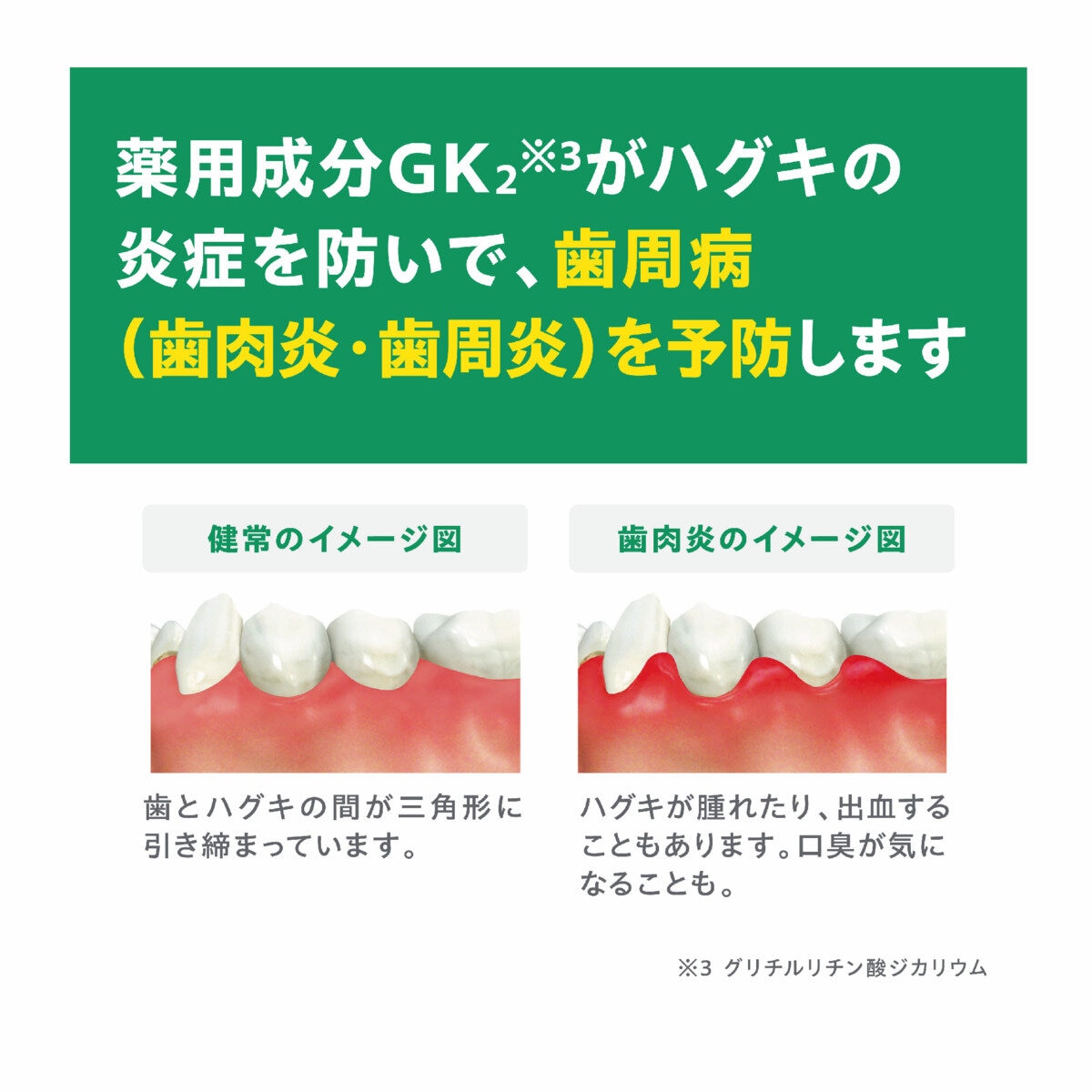 GUM (ガム) デンタルリンスレギュラータイプ 960ml x 3本+ 500ml