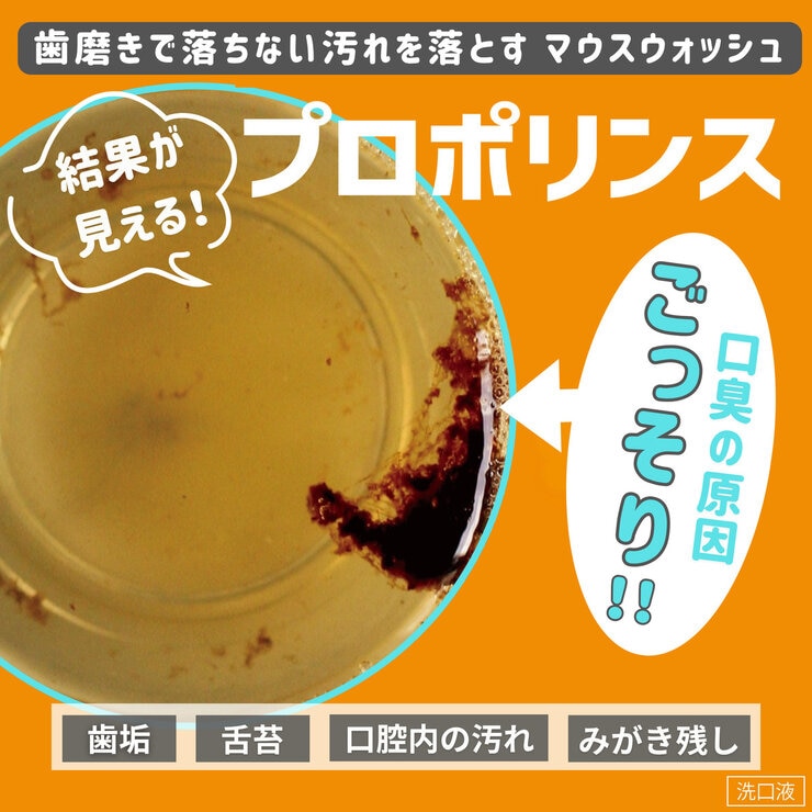 プロポリンス 汚れが見える マウスウォッシュ 1L x 3本セット プロポリンス 汚れが見える マウスウォッシュ 1L x 3本セット