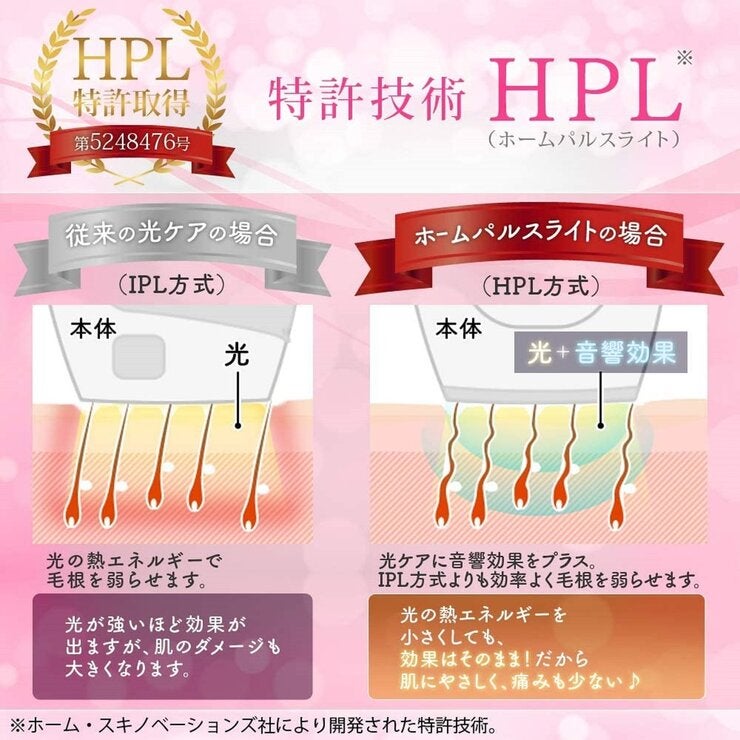 アイリスオーヤマ ホームパルスライト式 光美容器エピレタモーション EP-0337 アイリスオーヤマ ホームパルスライト式 光美容器エピレタモーション EP-0337