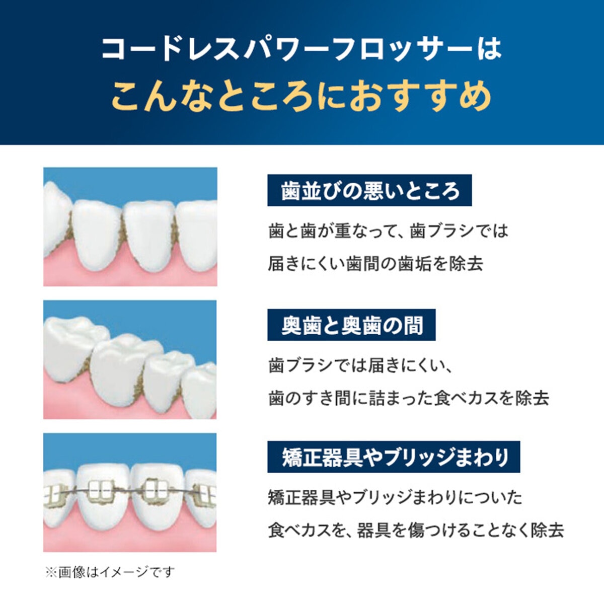 フィリップス コードレスパワーフロッサー3000 HX3806/34